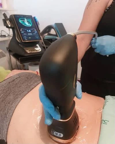LipoSonic